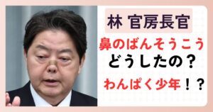 林官房長官の鼻の画像