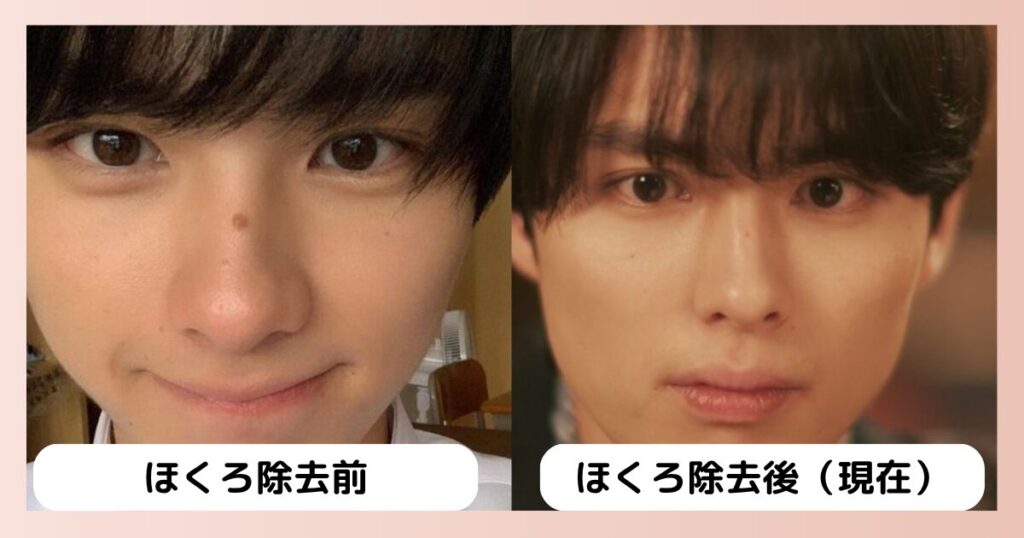 本田響矢,ほくろ,画像
